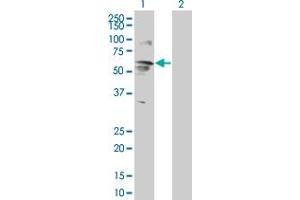 Image no. 1 for anti-Ectonucleotide Pyrophosphatase/phosphodiesterase 5 (ENPP5) (AA 1-477) antibody (ABIN528384)