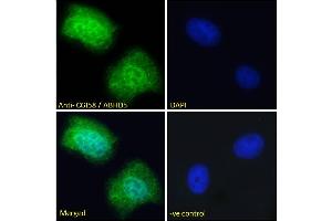 Image no. 1 for anti-Abhydrolase Domain Containing 5 (ABHD5) (Internal Region) antibody (ABIN190850)