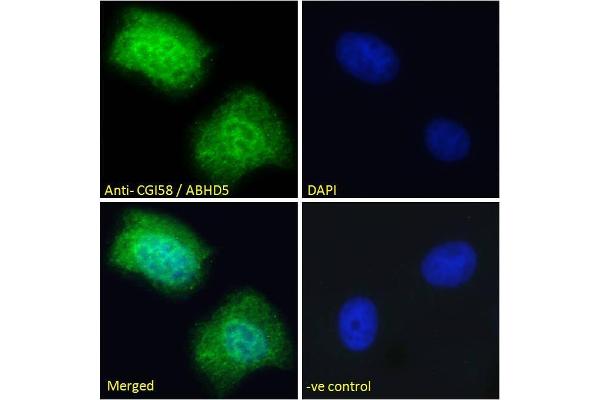 anti-Abhydrolase Domain Containing 5 (ABHD5) (Internal Region) antibody