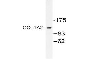 Image no. 2 for anti-Collagen, Type I, alpha 2 (COL1A2) (Chain alpha 2) antibody (ABIN498442)