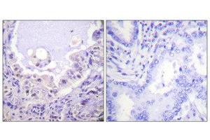 Image no. 1 for anti-V-Raf-1 Murine Leukemia Viral Oncogene Homolog 1 (RAF1) (Ser621) antibody (ABIN1847970)