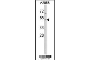 Image no. 1 for anti-ARP3 Actin-Related Protein 3 (ACTR3) (AA 380-407), (C-Term) antibody (ABIN389423)