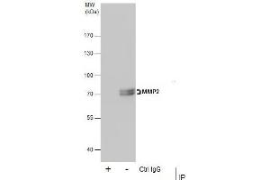 Image no. 7 for anti-Matrix Metalloproteinase 2 (MMP2) (Center) antibody (ABIN2855854)