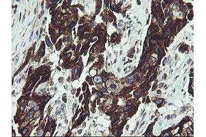 Image no. 1 for anti-Tumor Protein D52-Like 3 (TPD52L3) antibody (ABIN1501475)