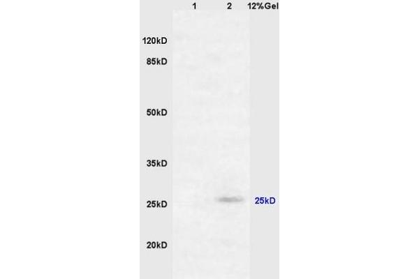 RASSF3 anticorps  (AA 51-150)