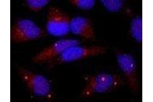 Immunofluorescence (IF) image for anti-Centrin, EF-Hand Protein, 1 (CETN1) (C-Term) antibody (ABIN2451941)