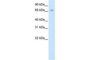Image no. 1 for anti-Kelch-like protein 41 (KLHL41) antibody (ABIN2461774)
