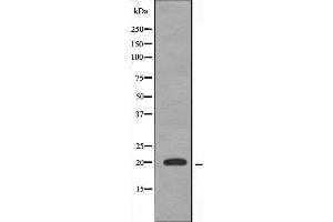 Image no. 1 for anti-Tumor Necrosis Factor, alpha-Induced Protein 8-Like 2 (TNFAIP8L2) (Internal Region) antibody (ABIN6259461)