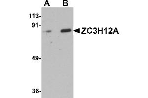 Western blot analysis of ZC3H12A in Raji cell lysate with ZC3H12A antibody at (A) 1 and (B) 2 µg/mL.