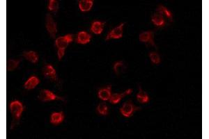 Image no. 1 for anti-Linker For Activation of T Cells (LAT) (pTyr255) antibody (ABIN6272038)