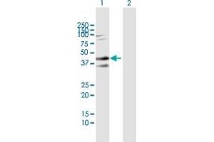 anti-Syndecan 2 (SDC2) (AA 19-201) antibody
