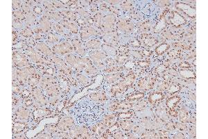 Image no. 2 for anti-Linker For Activation of T Cells (LAT) (pTyr161) antibody (ABIN6271566)