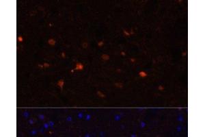 Immunofluorescence analysis of Mouse brain using S100B Polyclonal Antibody at dilution of 1:100.