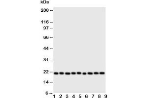Image no. 1 for anti-Cytoglobin (CYGB) (N-Term) antibody (ABIN3030693)