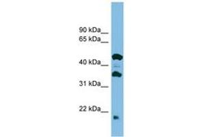 Image no. 1 for anti-Chromosome 11 Open Reading Frame 73 (C11orf73) (C-Term) antibody (ABIN6745127)
