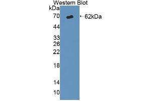 Image no. 1 for anti-ATP-Binding Cassette, Sub-Family D (Ald), Member 1 (ABCD1) (AA 102-386) antibody (ABIN5013194)