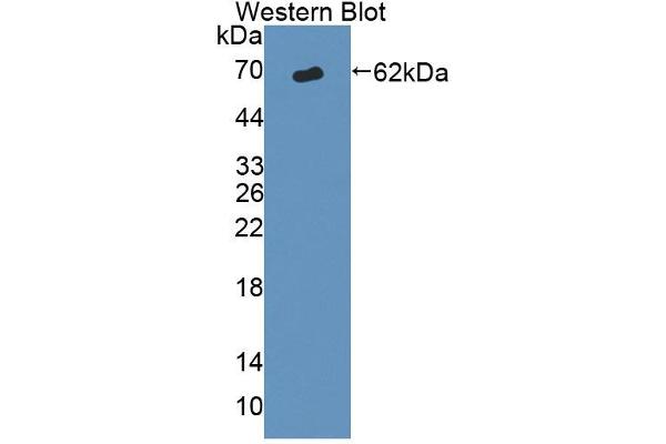 anti-ATP-Binding Cassette, Sub-Family D (Ald), Member 1 (ABCD1) (AA 102-386) antibody