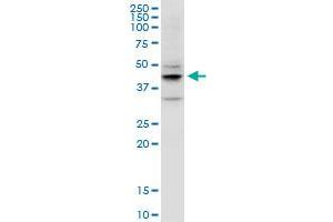 EPYC monoclonal antibody (M06), clone 2G6.