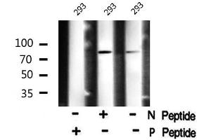 Image no. 1 for anti-MAP/microtubule Affinity-Regulating Kinase 2 (MARK2) (pThr596) antibody (ABIN6271320)