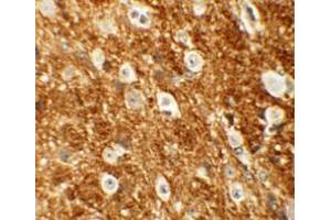Immunohistochemistry (IHC) image for anti-rho-Associated, Coiled-Coil Containing Protein Kinase 2 (ROCK2) (Middle Region) antibody (ABIN1031072)
