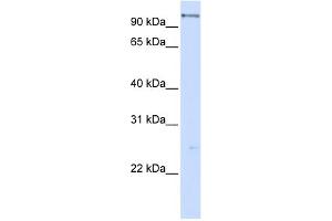 anti-DEAH (Asp-Glu-Ala-His) Box Polypeptide 15 (DHX15) (C-Term) antibody