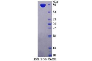 Image no. 1 for phosphodiesterase 3A, cGMP-Inhibited (PDE3A) (AA 948-1141) protein (GST tag,His tag) (ABIN6237461)