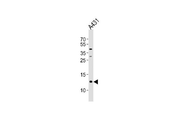SPRR2A 抗体  (C-Term)