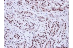 Image no. 1 for anti-Wilms Tumor 1 Associated Protein (WTAP) (Center) antibody (ABIN2855463)
