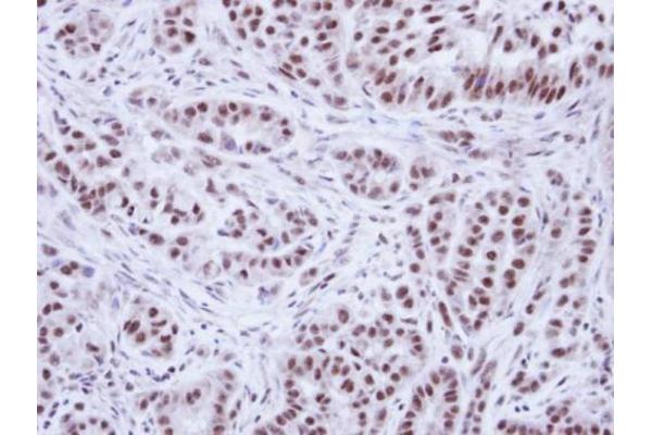 anti-Wilms Tumor 1 Associated Protein (WTAP) (Center) antibody