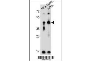 anti-Killer Cell Immunoglobulin-Like Receptor, Two Domains, Long Cytoplasmic Tail, 2 (KIR2DL2) (AA 263-291), (C-Term) antibody