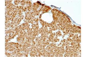 Image no. 2 for anti-Parathyroid Hormone (PTH) (AA 1-34) antibody (ABIN6940427)