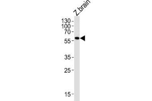 Image no. 1 for anti-Monoamine Oxidase (MAO) antibody (ABIN3004737)