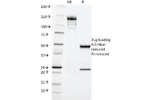 Image no. 5 for anti-Keratin 20 (KRT20) (AA 196-323) antibody (ABIN6940347)