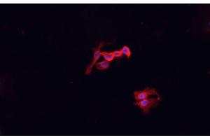 Image no. 3 for anti-Macrophage Scavenger Receptor 1 (MSR1) antibody (ABIN6263400)