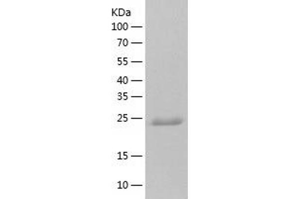 NUDT16L1 Protein (AA 1-211) (His tag)