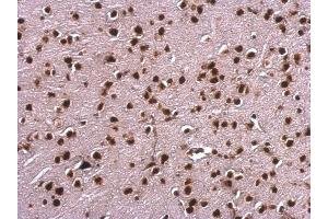 IHC-P Image Scaffold attachment factor B1 antibody detects Scaffold attachment factor B1 protein at nucleus on mouse fore brain by immunohistochemical analysis.
