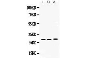 Image no. 2 for anti-Proteasome Subunit alpha Type 1 (PSMA1) (AA 159-204), (C-Term) antibody (ABIN4886704)