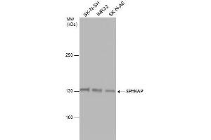 WB Image SPHKAP antibody detects SPHKAP protein by western blot analysis.