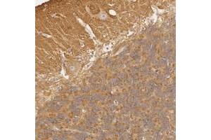 Image no. 2 for anti-Ral GTPase Activating Protein, alpha Subunit 1 (Catalytic) (RALGAPA1) antibody (ABIN5586749)