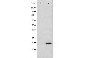 Image no. 4 for anti-Stathmin 1 (STMN1) (pSer15) antibody (ABIN6256152)