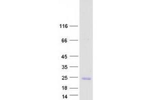 Image no. 1 for TP53 Apoptosis Effector (PERP) protein (Myc-DYKDDDDK Tag) (ABIN2728716)