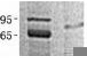 PPIE Protein (Transcript Variant 1) (His tag)