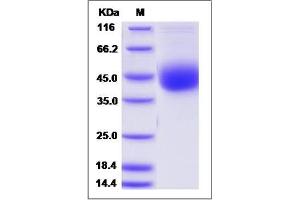 Image no. 1 for ADP-Ribosyltransferase 4 (Dombrock Blood Group) (ART4) (AA 31-300) protein (His tag) (ABIN2010071)