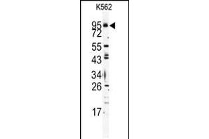 Image no. 1 for anti-Toll-Like Receptor 6 (TLR6) (AA 722-753), (C-Term) antibody (ABIN5535024)