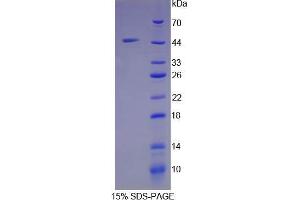 Image no. 1 for Ribonuclease, RNase A Family, 1 (Pancreatic) (RNASE1) protein (ABIN3011502)