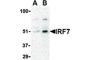 Image no. 1 for anti-Interferon Regulatory Factor 7 (IRF7) (Internal Region) antibody (ABIN6655157)