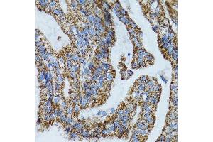 Image no. 5 for anti-Mitochondrial Ribosomal Protein L28 (MRPL28) antibody (ABIN6144010)