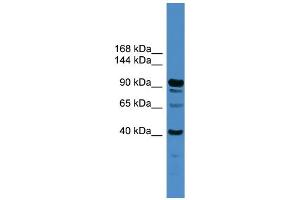 Image no. 2 for anti-Intraflagellar Transport 88 Homolog (IFT88) (Middle Region) antibody (ABIN2785505)