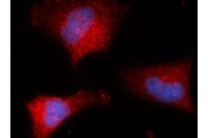 Image no. 1 for anti-Peptidylprolyl Isomerase G (Cyclophilin G) (PPIG) (AA 1-175) antibody (PE) (ABIN5567270)
