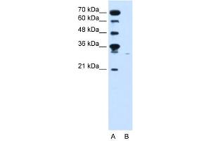 Image no. 2 for anti-Solute Carrier Family 22 (Organic Cation Transporter), Member 7 (SLC22A7) (C-Term) antibody (ABIN2775547)